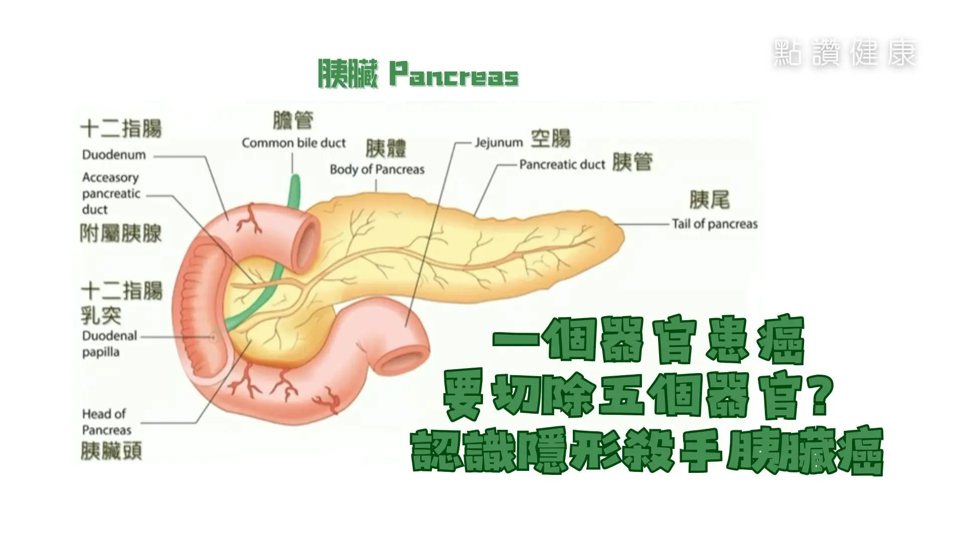 一個器官患癌要切除五個器官？認識隱形殺手胰臟癌: 