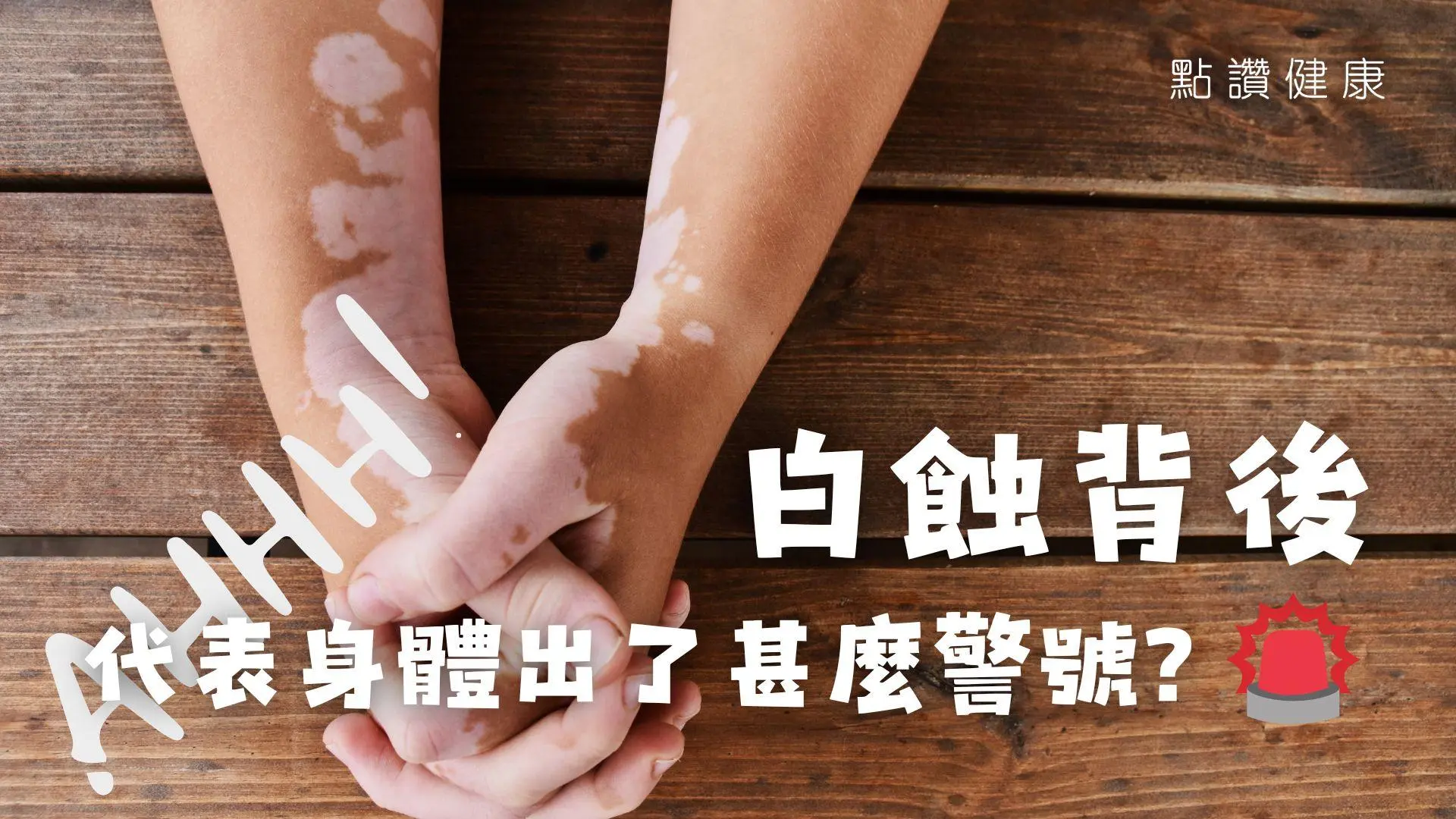 皮膚白斑等不等於白蝕？白蝕不痛不癢，完全不求診也沒問題嗎？: 