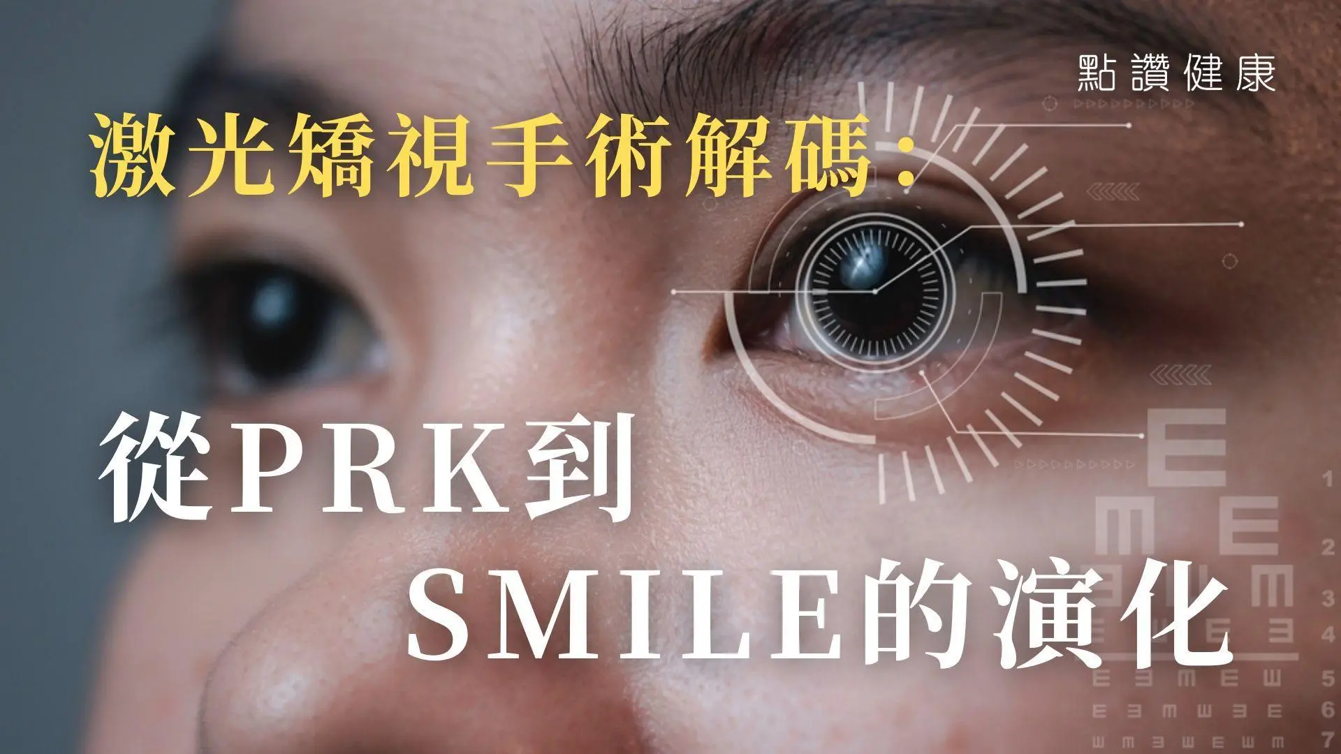 激光矯視手術解碼：從PRK到SMILE的演化: 