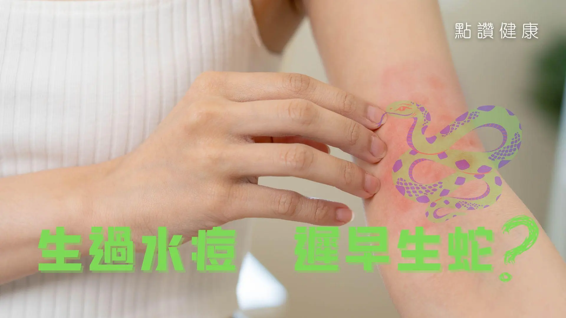 生蛇是甚麼？癌症患者是否較易生蛇？他們能否接種蛇針？: 