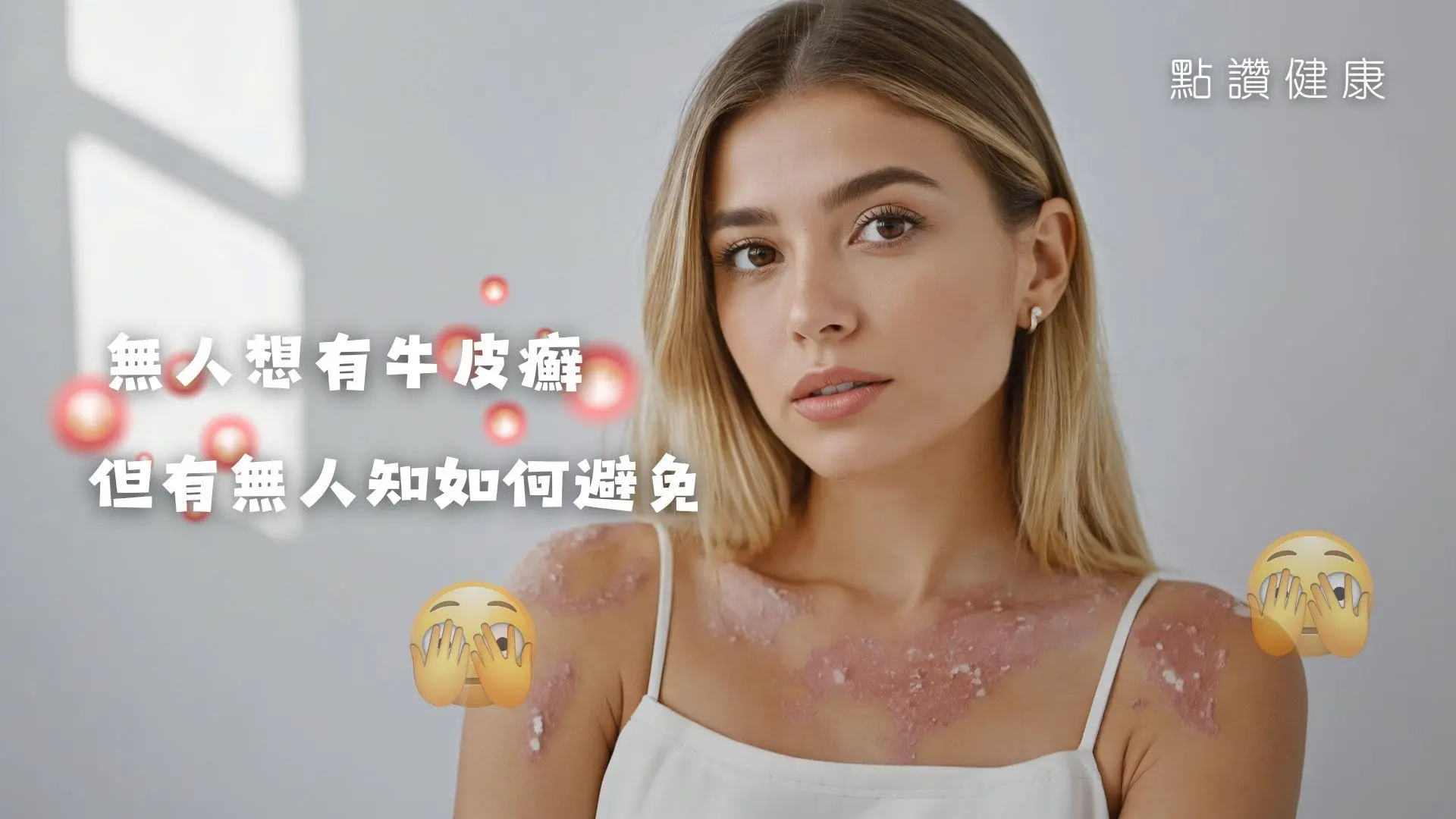 牛皮癬（銀屑病）為何發生？對外觀和身體機能有何影響？: 