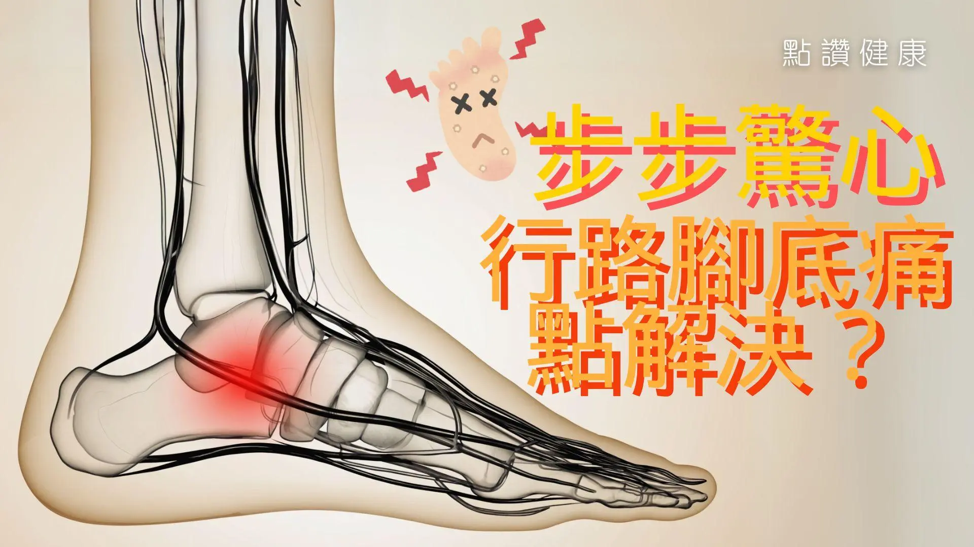 走路腳底痛？拇趾外翻、足底筋膜炎有何病徵和治療方法？: 