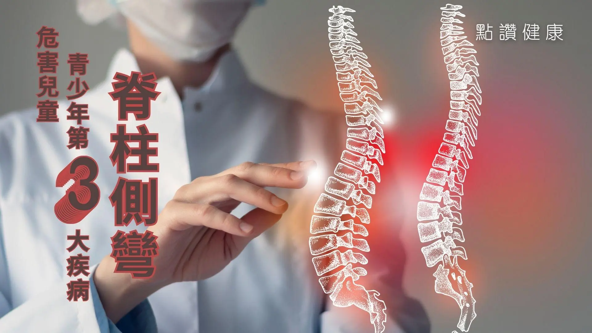 發病年齡是治療關鍵！詳談兒童常見脊骨問題：脊柱側彎的類型、徵狀、影響及療法: 