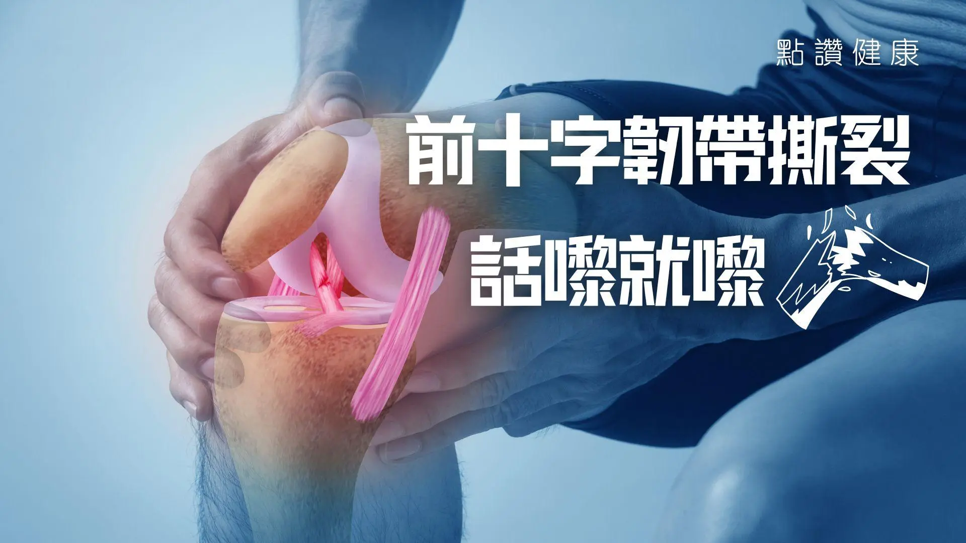 行路、踎低都有可能導致前十字韌帶撕裂？撕裂後必須做手術？會不會慣性復發？: 