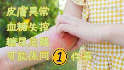 【糖尿病皮膚警號】眼周浮腫、皮膚癢、長癬？6大皮膚異常恐是糖尿病前兆！