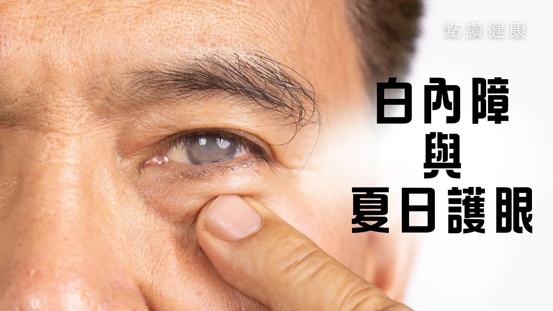 【眼科專科指南】夏日護眼關鍵 + 白內障成因解析｜紫外線防護必知: 