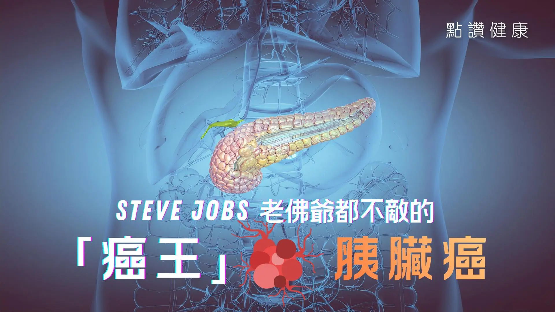 胰臟癌又稱「癌症王」，不但成因成謎，初期無徵狀，術後也可能復發！一起認識這種可怕的癌症: 